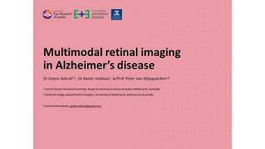 Multimodal retinal imaging in Alzheimer’s disease