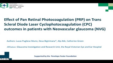 Effect of pan retinal photocoagulation (PRP) on Trans scleral diode laser Cyclophotocoagulation (CPC) outcomes in patients with neovascular glaucoma (NVG).