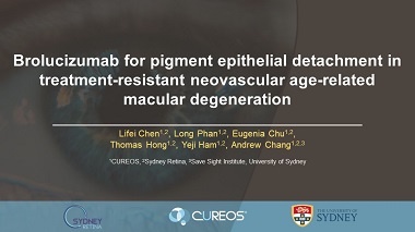 Brolucizumab Treatment for Pigment Epithelial Detachment in Treatment-Resistant Neovascular Age Related Macular Degeneration.