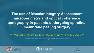 The use of Macular Integrity Assessment microperimetry and optical coherence tomography in patients undergoing epiretinal membrane peeling surgery