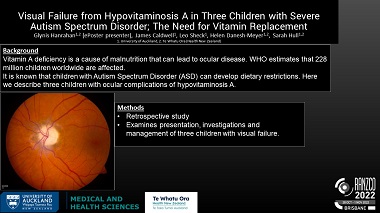 Visual Failure from Hypovitaminosis A in Three Children with Severe Autism Spectrum Disorder; The Need for Vitamin Replacement