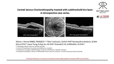 Central serous chorioretinopathy treated with focal subthreshold 3 ns laser: A retrospective case series review of 84 eyes of 80 patients.