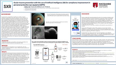 Eye trauma and the use of Artificial intelligence for improved workplace safety with compliance improvement.