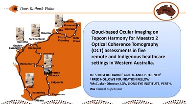 Cloud-based ocular imaging on Topcon Harmony for Maestro 2 Optical Coherence Tomography (OCT) assessments in five remote and Indigenous healthcare settings in Western Australia.