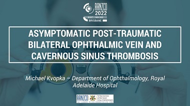 Asymptomatic Post-Traumatic Bilateral Ophthalmic Vein and Cavernous Sinus Thrombosis