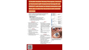 Double Trouble? Practical Management Guidelines for Excision of Double-headed “Kissing” Pterygium