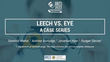 Leech versus eye – A Case Report