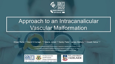 Approach to an intracanalicular vascular malformation