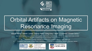 Orbital artifacts on magnetic resonance imaging