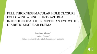 Full thickness macular hole closure following a single intravitreal injection of aflibercept in an eye with diabetic macular oedema