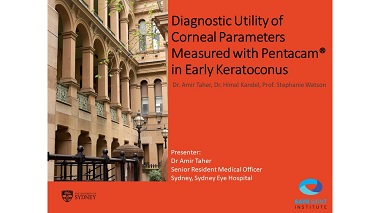 Diagnostic utility of corneal parameters measured with Pentacam in the diagnosis of early Keratoconus