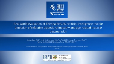 Real world evaluation of Thirona RetCAD artificial intelligence tool for detection of referrable diabetic retinopathy and age-related macular degeneration