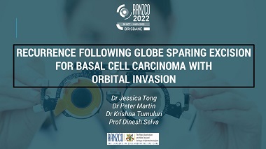 Recurrence following globe sparing excision for basal cell carcinoma with anterior orbital invasion