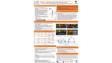 Genotype, Phenotype and Natural History of PROM1 inherited retinal dystrophies (IRD)